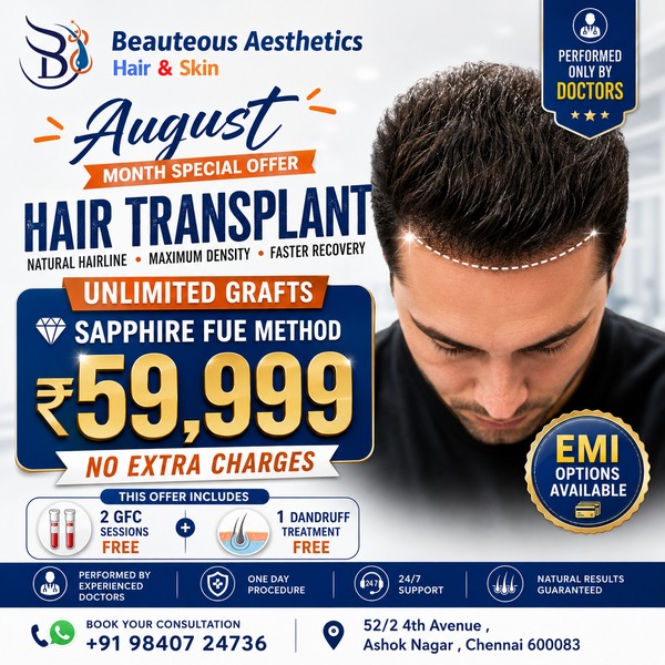 August Special Offer Sapphire FUE Hair Transplant