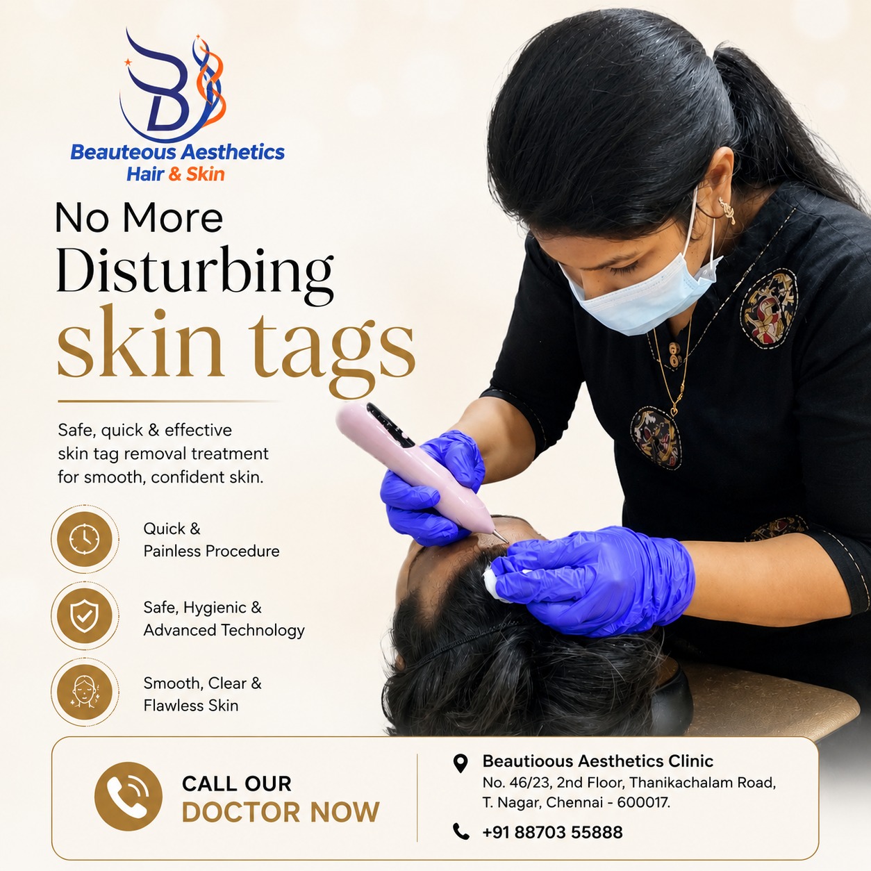 Skin Tag Removal in Chennai Beautious Aesthetics