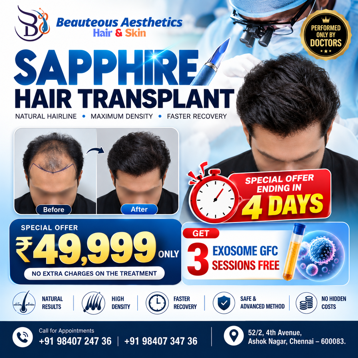 Sapphire Hair Transplant in Chennai at ₹49,999 – 3 Exosome GFC FREE